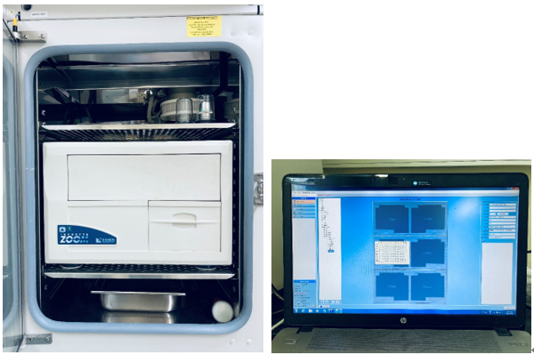 Incucyte ZOOM (Essenbioscience)